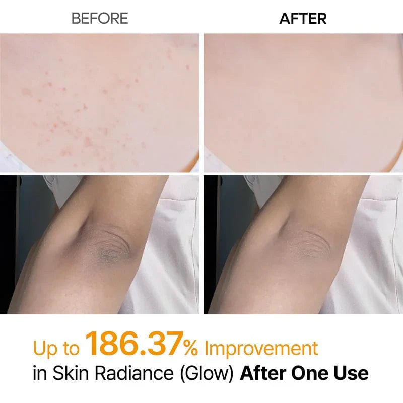 🖤2026 New Year · 40% OFF🖤Shot Keratin Care Kojic Acid Turmeric Spray