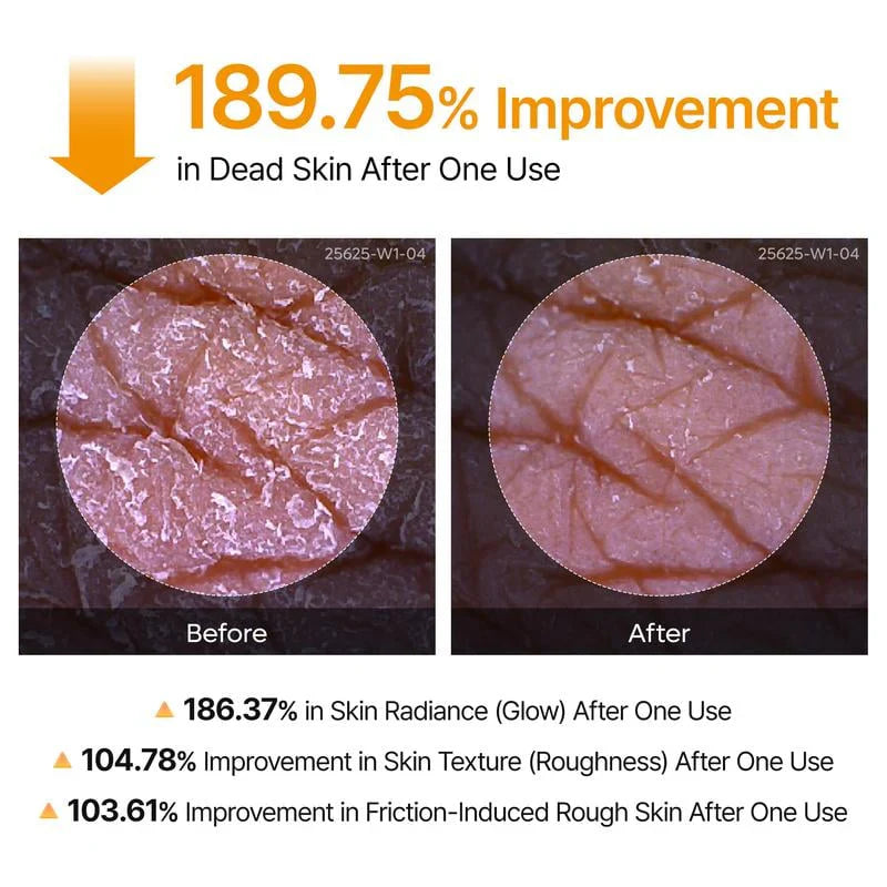 🖤2026 New Year · 40% OFF🖤Shot Keratin Care Kojic Acid Turmeric Spray