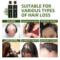 💖 See Real Results Faster -Tgideas® Organic Rosemary Hair Growth shampoo