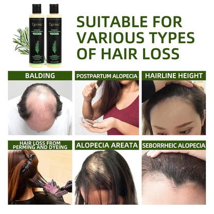 💖 See Real Results Faster -Tgideas® Organic Rosemary Hair Growth shampoo