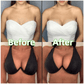 🔥 Buy One Get One Free!!💐OUFALI Lift Inserts for Bras – Lightly Padded, Double-Sided Adhesive Reusable, Washable • Natural Lift • Seamless Under Clothing