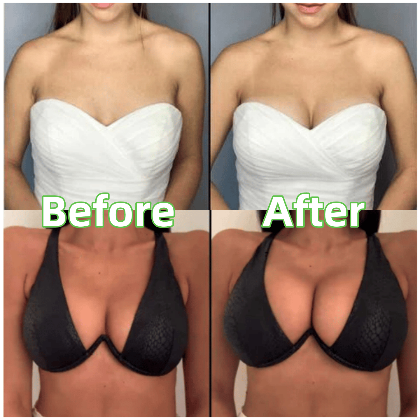 🔥 Buy One Get One Free!!💐OUFALI Lift Inserts for Bras – Lightly Padded, Double-Sided Adhesive Reusable, Washable • Natural Lift • Seamless Under Clothing
