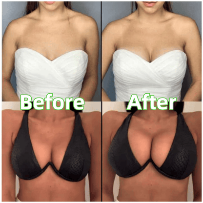 🔥 Buy One Get One Free!!💐OUFALI Lift Inserts for Bras – Lightly Padded, Double-Sided Adhesive Reusable, Washable • Natural Lift • Seamless Under Clothing