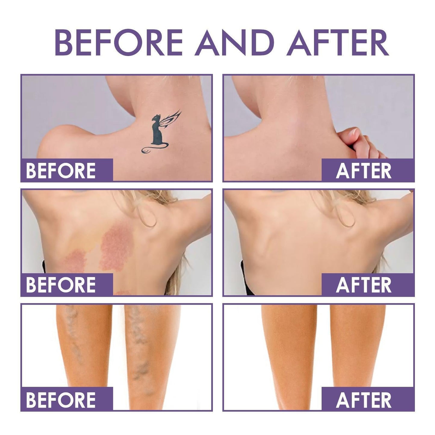 💜Last Day Buy 2 Get 1 Free!💜✨Body Coverage Perfector – Waterproof, Lightweight & Flawless Body Makeup