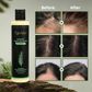 💖 See Real Results Faster -Tgideas® Organic Rosemary Hair Growth shampoo