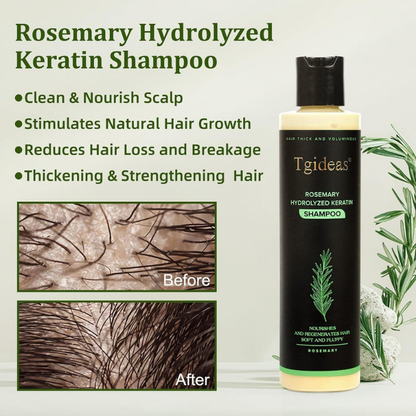 💖 See Real Results Faster -Tgideas® Organic Rosemary Hair Growth shampoo