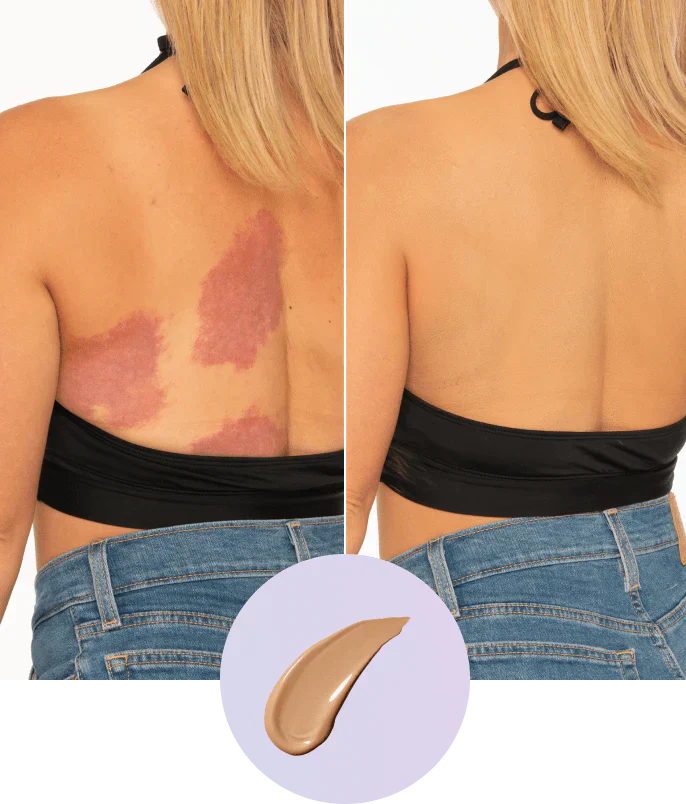 💜Last Day Buy 2 Get 1 Free!💜✨Body Coverage Perfector – Waterproof, Lightweight & Flawless Body Makeup