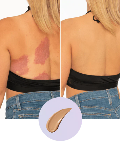 💜Last Day Buy 2 Get 1 Free!💜✨Body Coverage Perfector – Waterproof, Lightweight & Flawless Body Makeup