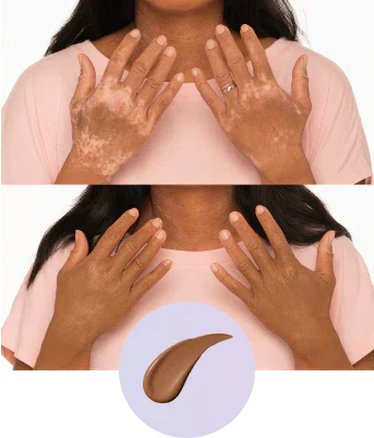 💜Last Day Buy 2 Get 1 Free!💜✨Body Coverage Perfector – Waterproof, Lightweight & Flawless Body Makeup