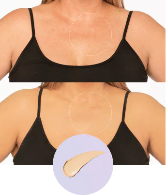 💜Last Day Buy 2 Get 1 Free!💜✨Body Coverage Perfector – Waterproof, Lightweight & Flawless Body Makeup