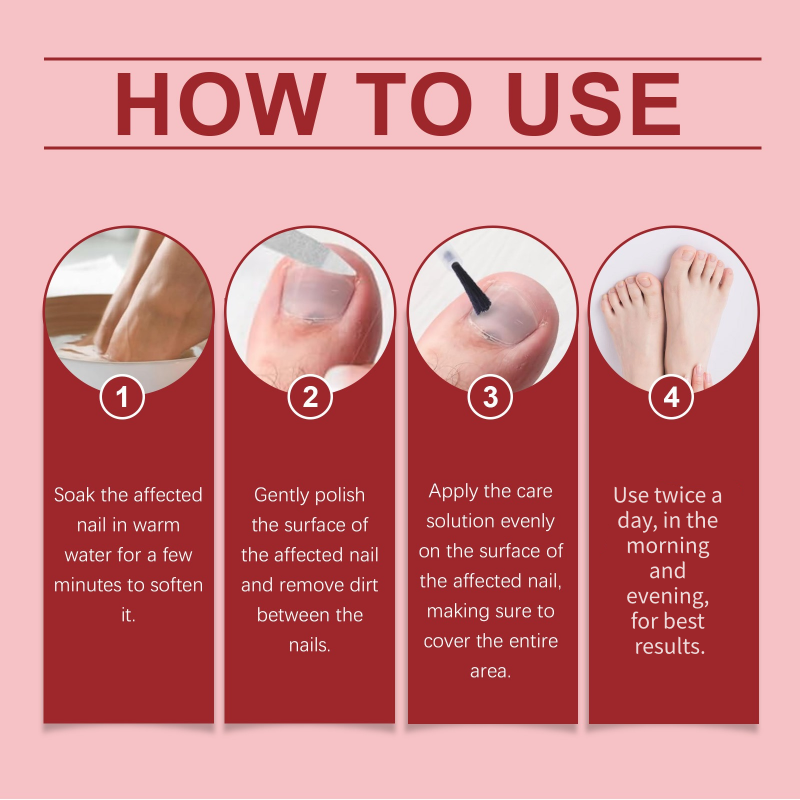 🖤See Real Results Faster🖤Nail Repair Essence for Damaged Nails💅🏻