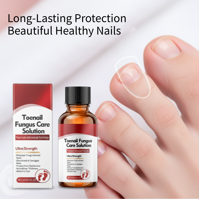 🖤See Real Results Faster🖤Nail Repair Essence for Damaged Nails💅🏻