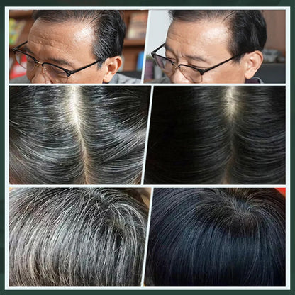 ✨ German Plant-Based Hair Dye for Salon-Perfect Roots – 100% Plant Power, Easy to Use & Covers Gray Hair in 5 Minutes 🌿