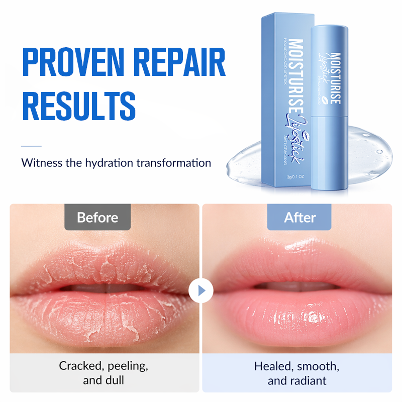 Limited BOGO⏰️24H Lip Repair Balm – Ice Cream Texture & Deep Hydration Formula