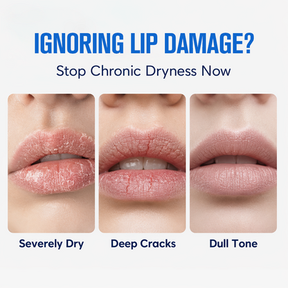 Limited BOGO⏰️24H Lip Repair Balm – Ice Cream Texture & Deep Hydration Formula